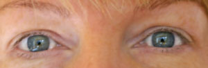 Lorraine's eyelashes before