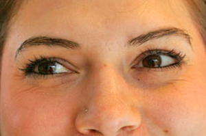 Before Eyebrow Threading